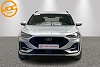 Ford Focus ST-Line thumbnail